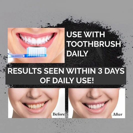 JMT-470154 Natural Activated Charcoal Teeth Whitening Powder 30g for Oral Care and Stain Removal