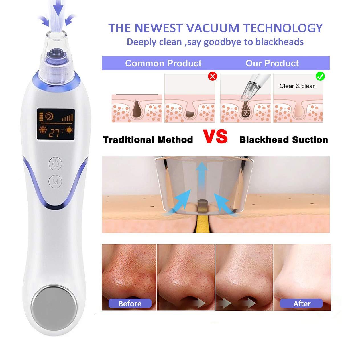 JMT-008394 Hot and Cold Suction Blackhead Remover with Cooling and Heating Functions
