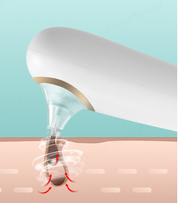 JMT-019338 Electric Facial Cleansing Instrument with Strong Suction and Blue Light Sterilization