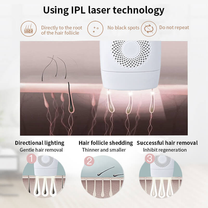 JMT-023050 IPL Laser Hair Removal Device with LCD Display and 5 Energy Levels - 990,000 Pulses