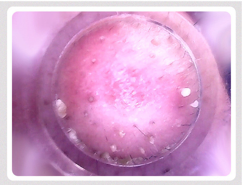 JMT-039754 Electric Blackhead Remover and Pore Cleansing Device with Facial Massage Function, 3 Adjustable Gears, White and Green Options