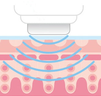 JMT-056970 5-in-1 Rechargeable Ultrasonic Skin Rejuvenation Device for Facial Massage and Treatment
