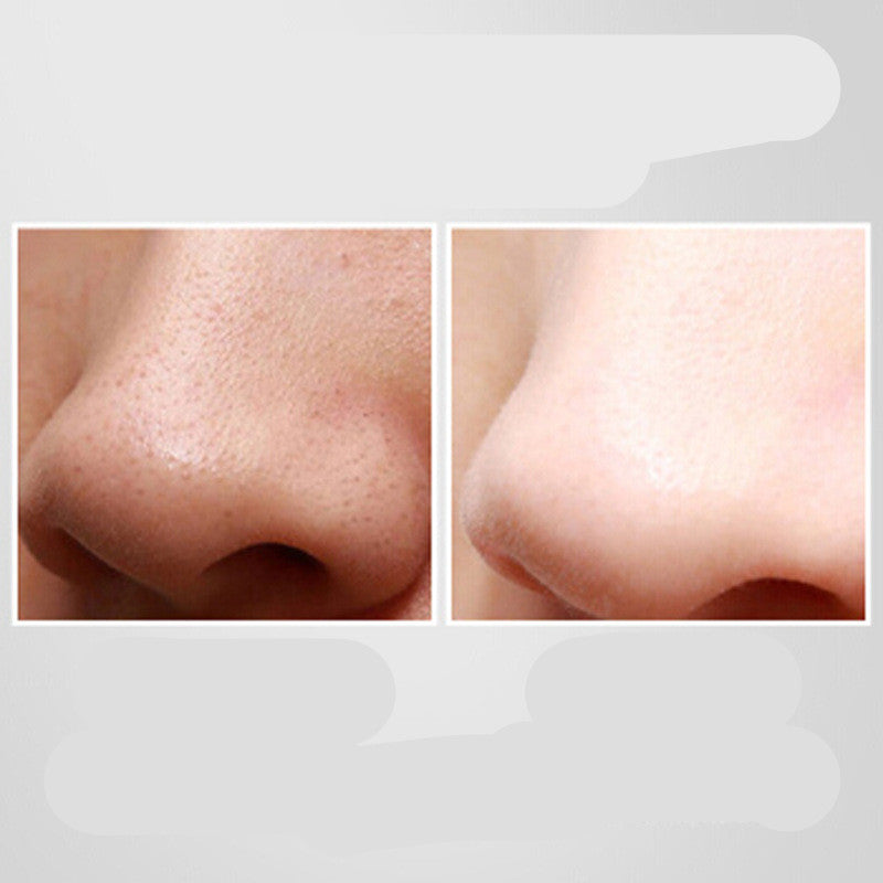 JMT-073930 Ultrasonic Pore Cleaner & Blackhead Remover with Red and Blue Light Therapy