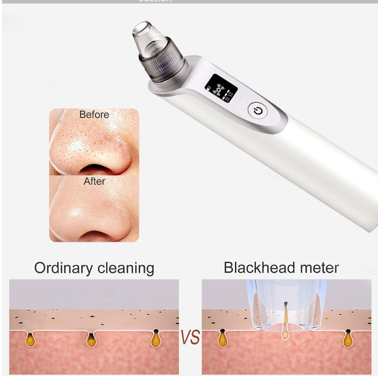 JMT-075082 Ultrasonic Blackhead Removal Device with Infrared Light and Multi-Function Features