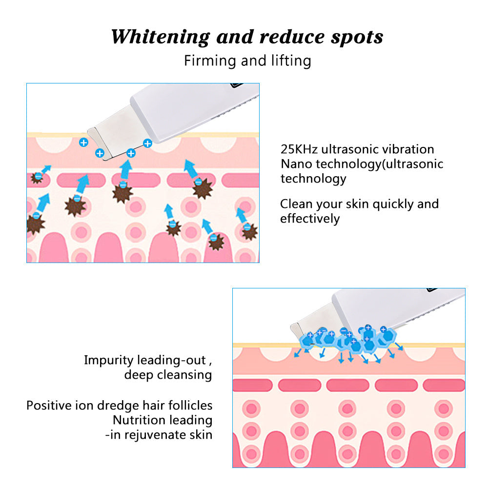 JMT-092042 Ultrasonic Skin Cleansing Device with Ionic Technology for Deep Cleaning and Improved Skin Elasticity