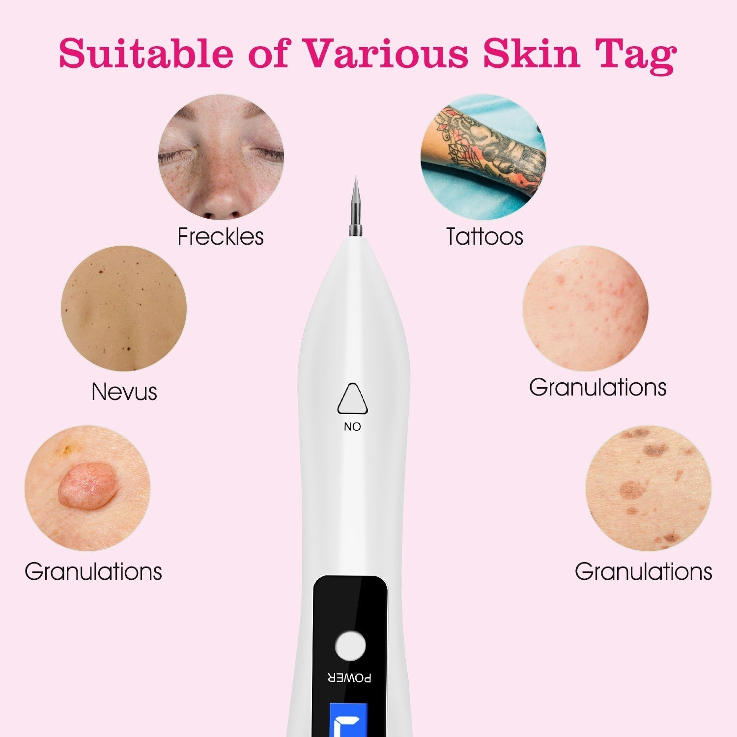 JMT-133450 2-Piece Skin Tag Repair Kit with Adjustable Intensity and Fast Healing Function