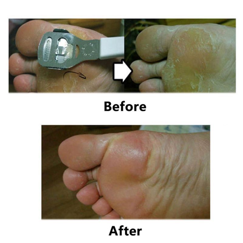 JMT-149578 Stainless Steel Multifunctional Foot Planer, 14.2cm - Durable and Corrosion Resistant