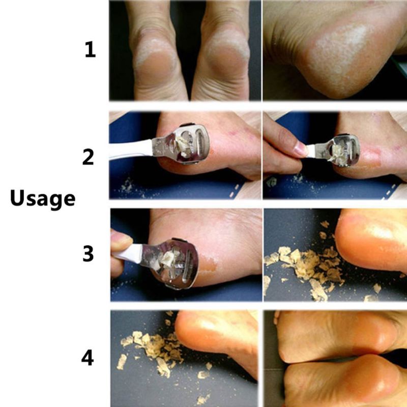 JMT-149578 Stainless Steel Multifunctional Foot Planer, 14.2cm - Durable and Corrosion Resistant