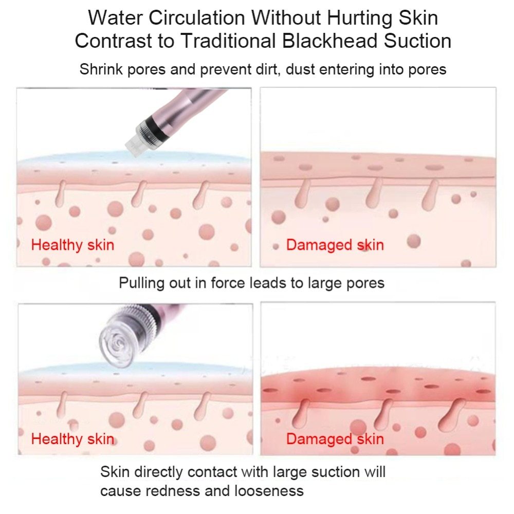 JMT-186634 Portable Oxygen Spray Hydro Jet Face Care Machine for Blackhead Removal and Skin Rejuvenation