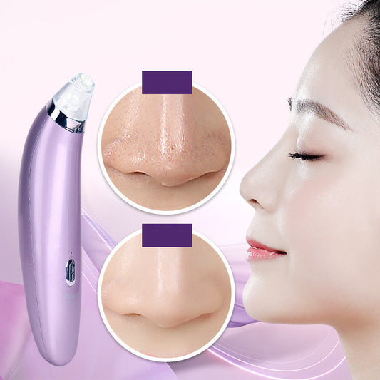JMT-345866 Electric Blackhead Remover with Rotating Suction Function - Facial Cleansing Tool 180mm x 40mm