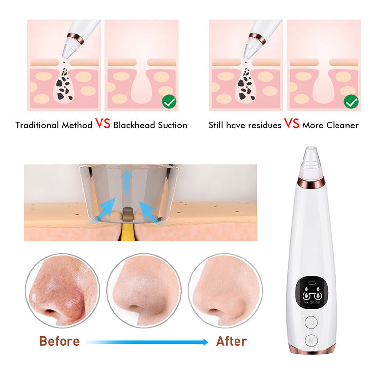 JMT-352778 Facial Cleanser with Vacuum Technology for Blackhead Removal and Pore Tightening