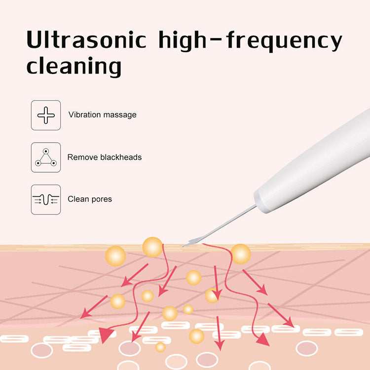 JMT-385802 Ultrasonic Facial Exfoliation Shovel for Home Use - White