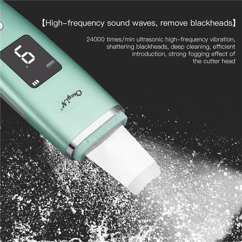 JMT-403658 Ultrasonic Negative Ion Blackhead Vacuum Cleaner with Deep Pore Cleansing and Nano Spray Function
