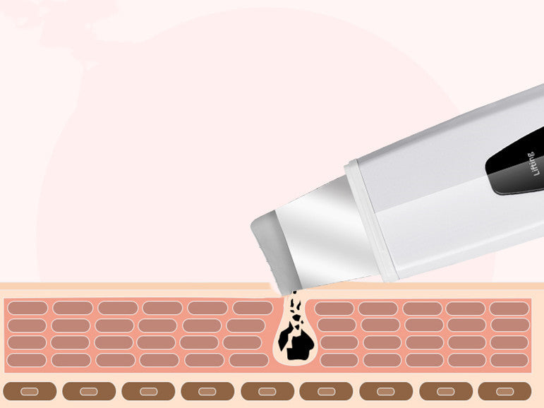 JMT-416010 Ultrasonic Ion Skin Cleanser C-106 for Effective Deep Cleansing and Revitalization