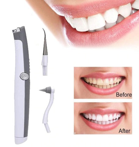 JMT-416266 Sonic Teeth Whitening Kit with LED Light and 4 Interchangeable Grinding Heads for Tartar Removal