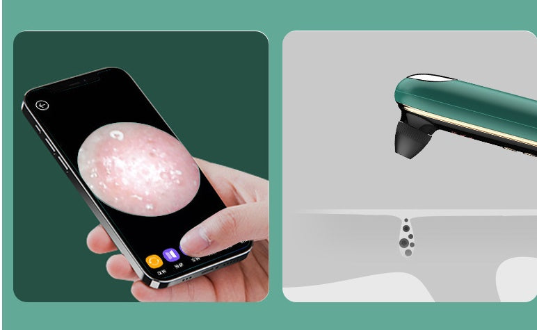JMT-485258 Wireless Blackhead Removal Device with Visual Feedback and Electric Rotation