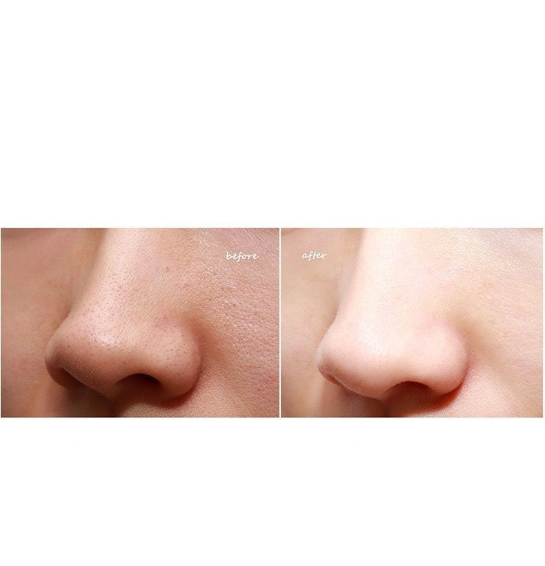 JMT-495050 Electric Facial Cleansing Tool for Blackhead Removal - 450mAh Battery, High Suction Power