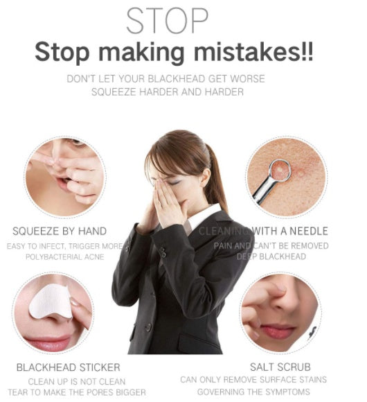 JMT-501066 Electric Blackhead Suction Device with 4 Suction Heads for Pore Cleansing and Acne Removal