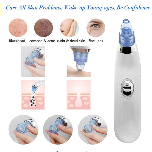 JMT-664906 Blackhead Removal Device with 3.7V Rated Voltage and 4W Power