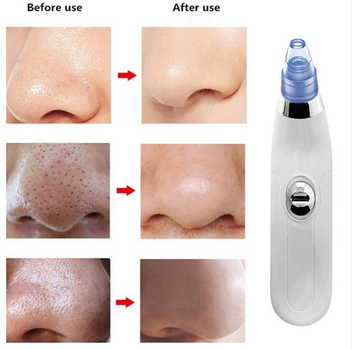 JMT-664906 Blackhead Removal Device with 3.7V Rated Voltage and 4W Power
