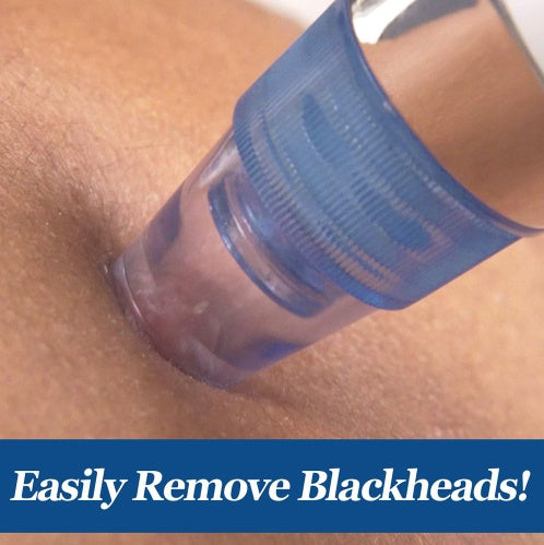 JMT-664906 Blackhead Removal Device with 3.7V Rated Voltage and 4W Power