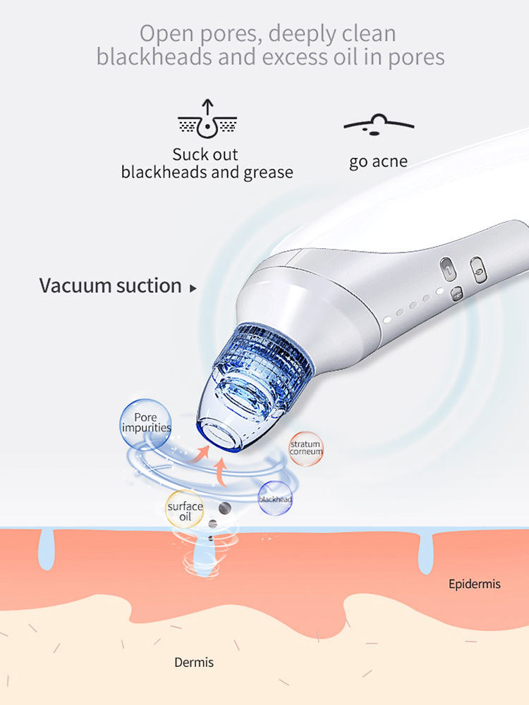 JMT-678154 Electric Blackhead Removal Device with Vacuum Suction - Includes 4 Replaceable Heads, Base Charging, and Instruction Manual