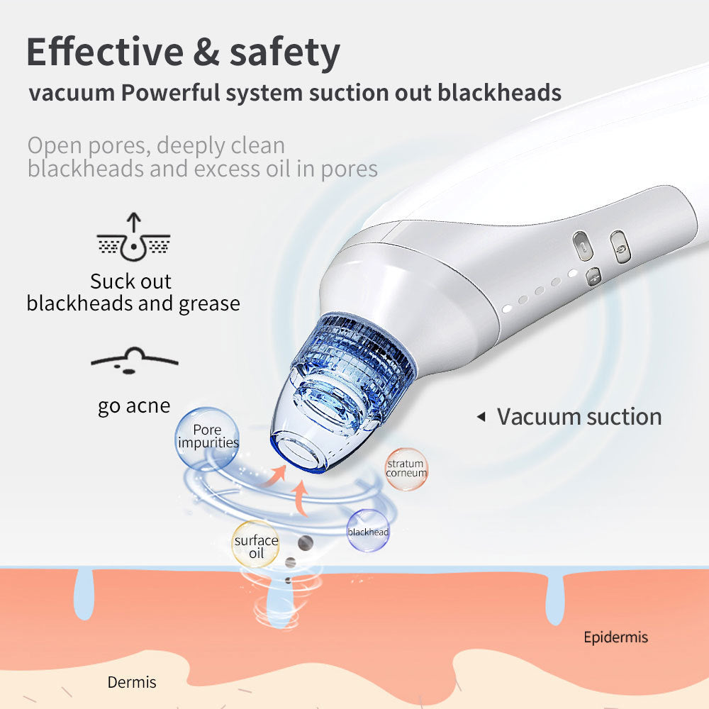 JMT-678154 Electric Blackhead Removal Device with Vacuum Suction - Includes 4 Replaceable Heads, Base Charging, and Instruction Manual