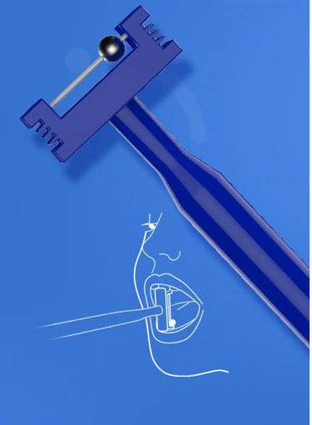 JMT-697674 Tongue Tip Training Set for Oral Muscle Flexibility - 3 Pieces