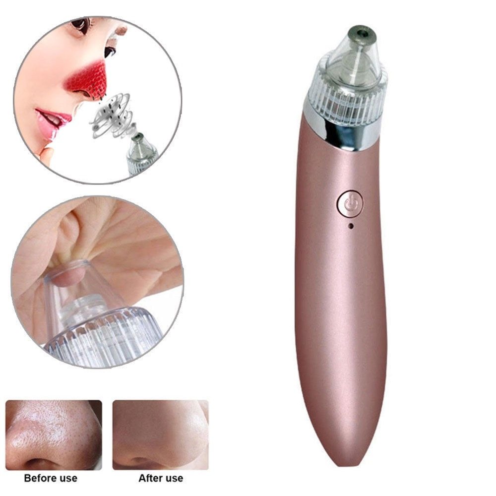 JMT-701130 Facial Blackhead Extractor with 4 Removable Heads and Adjustable Suction for Deep Cleansing