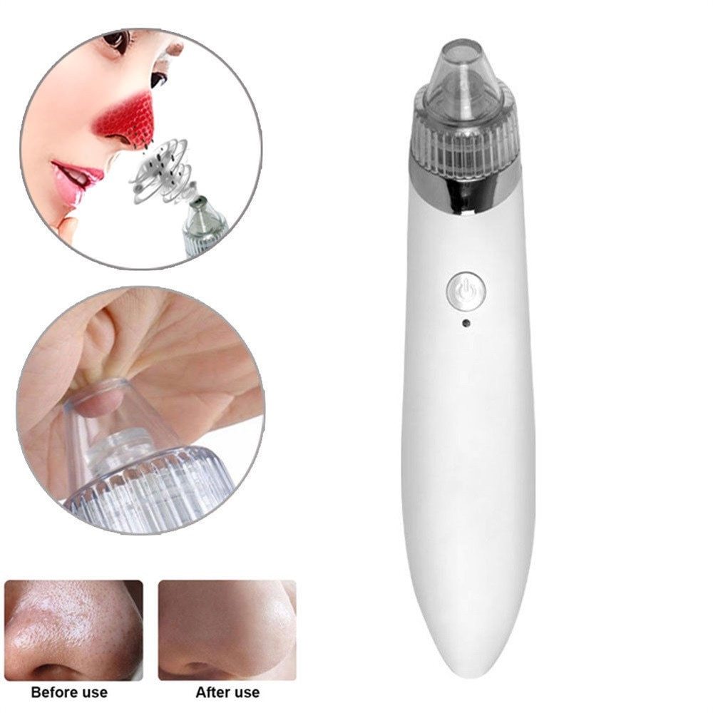 JMT-701130 Facial Blackhead Extractor with 4 Removable Heads and Adjustable Suction for Deep Cleansing