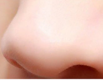 JMT-707466 Intelligent Blackhead Removal Device with Hot and Cold Cupping Feature