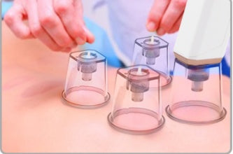 JMT-707466 Intelligent Blackhead Removal Device with Hot and Cold Cupping Feature