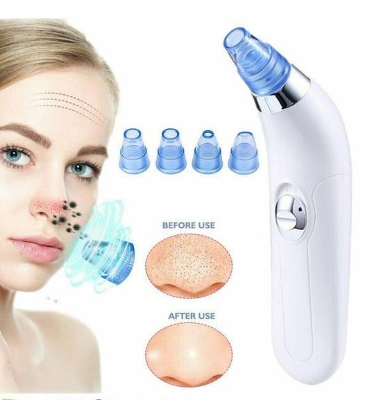 JMT-716938 Facial Pore Cleaner with Vacuum Suction for Acne and Skin Rejuvenation
