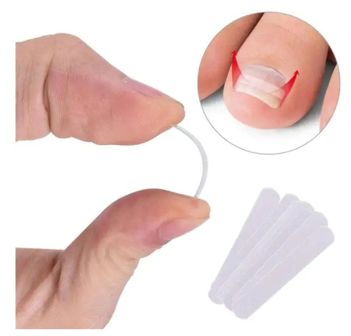 JMT-721290 Ingrown Toenail Correction Patch for Healthy Nail Growth and Pain Relief