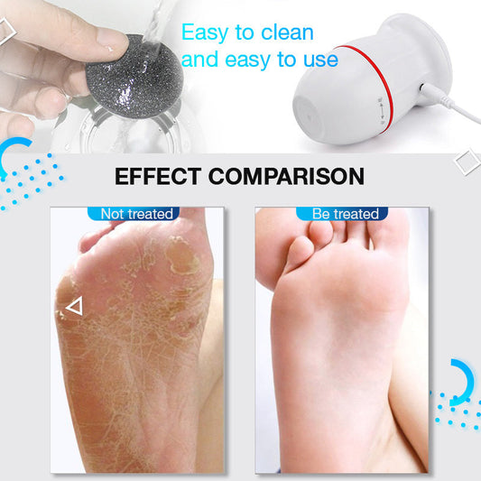 JMT-728138 Rechargeable Electric Foot Grinder for Removing Dead Skin and Calluses