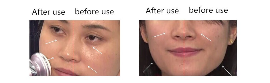 JMT-743690 Microcurrent Electroporation Beauty Device with Negative Ion and Radio Frequency - Portable Silver Instrument for Home Use