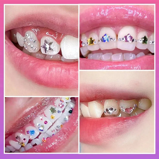 JMT-772234 Gold Tooth Gem DIY Kit for Smile Enhancements