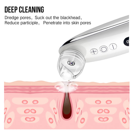 JMT-794570 Effective Blackhead Remover with Adjustable Suction Speed and Built-in LED Light