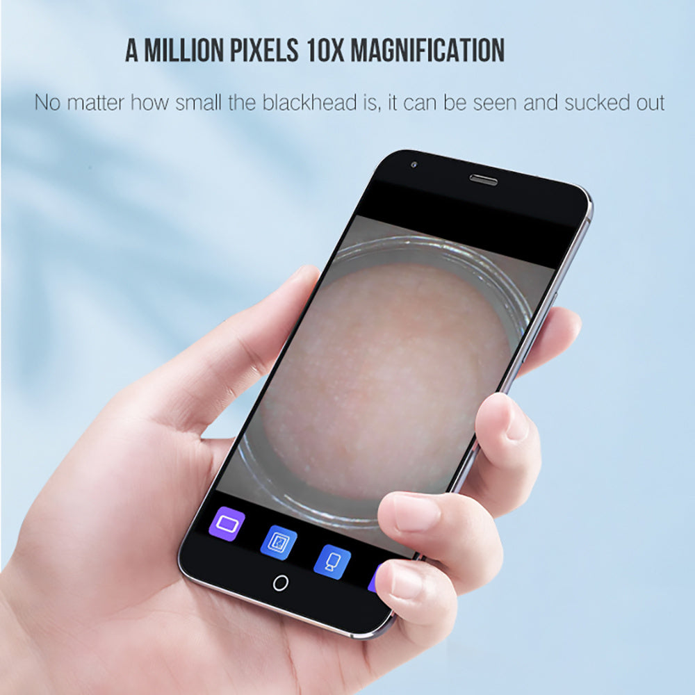 JMT-794570 Effective Blackhead Remover with Adjustable Suction Speed and Built-in LED Light