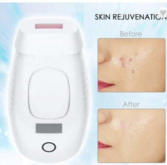 JMT-809482 Whole Body Laser Hair Removal Device with WPL Technology and 600,000 Lifespan