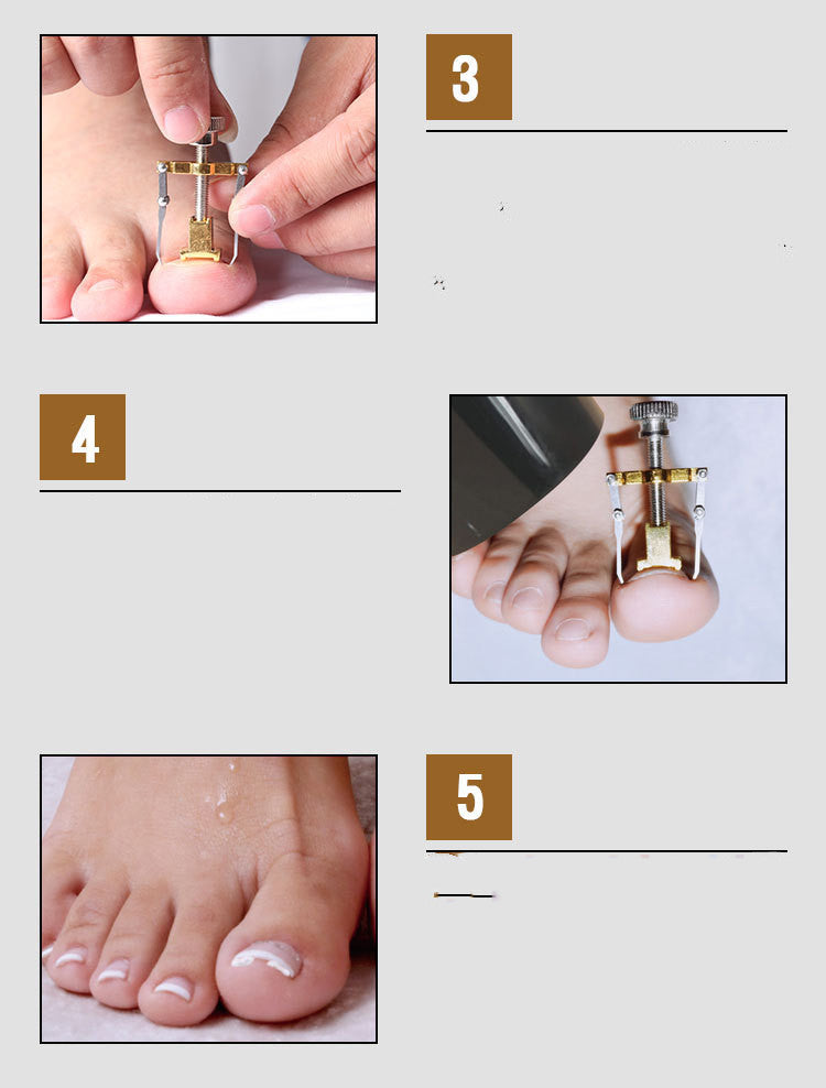 JMT-843466 Stainless Steel Toenail Clippers and Corrector Manicure Set for Inflammation Relief