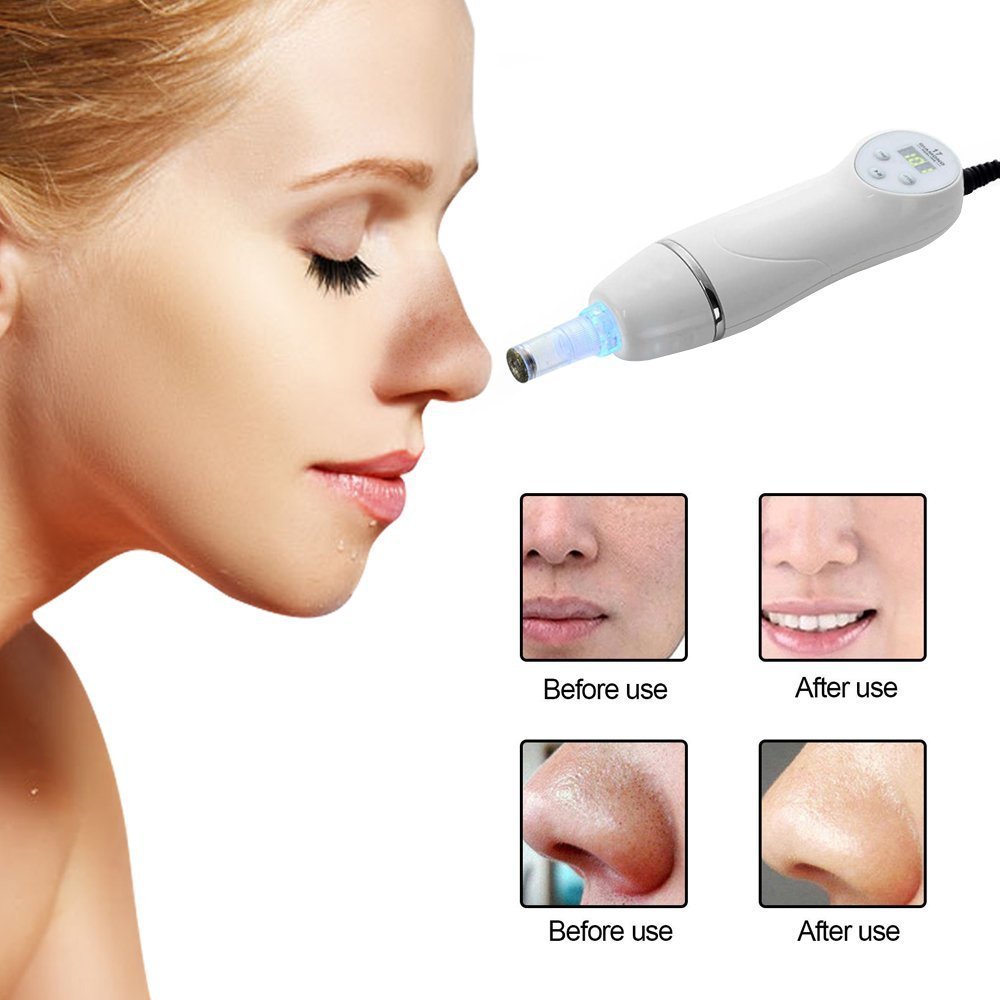 JMT-892874 Electric Blackhead Remover with 3 Suction Nozzles and Microcrystalline Heads for Deep Pore Cleansing