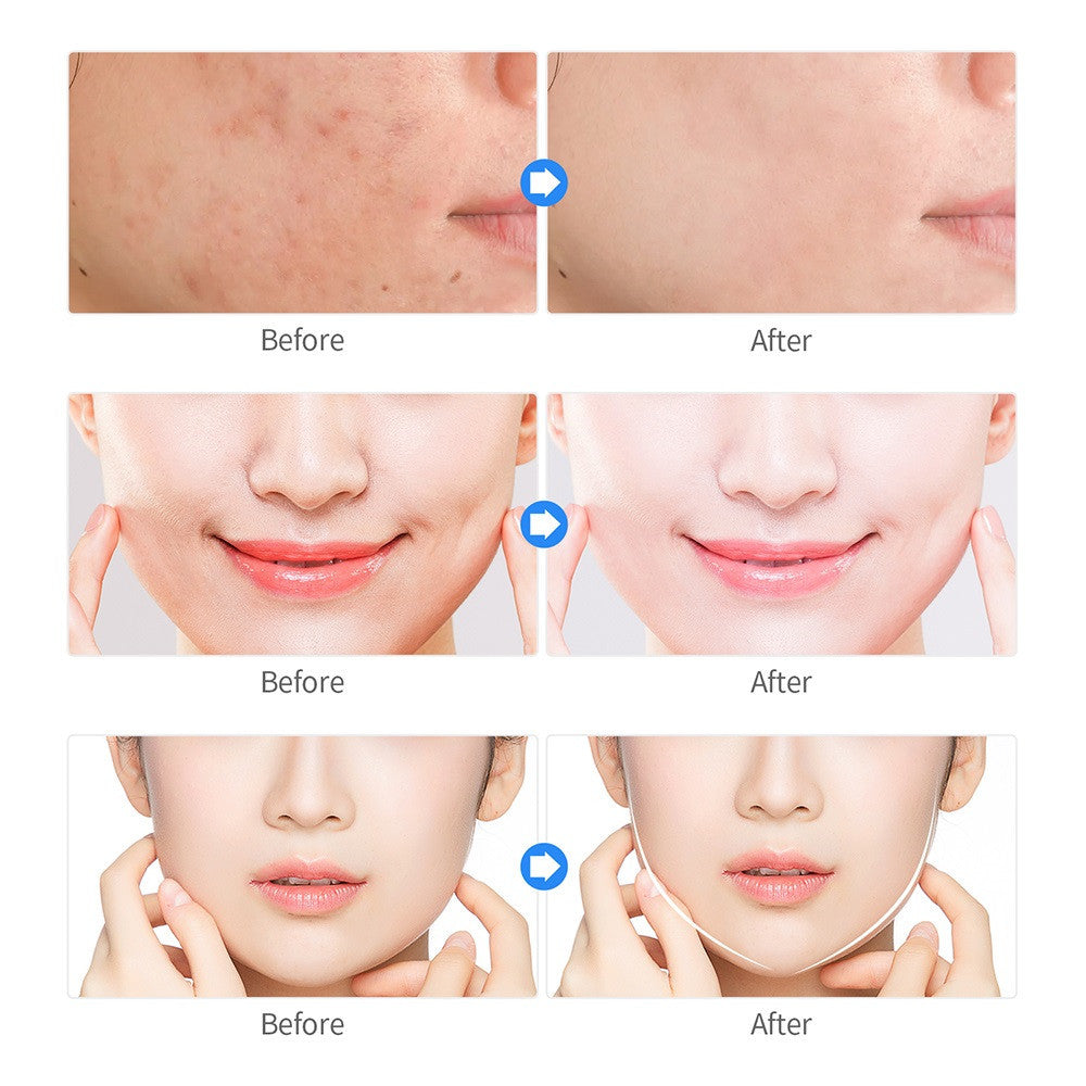 JMT-994890 Plasma Facial Cleansing and Acne Rejuvenation Device, Portable Pink Beauty Instrument